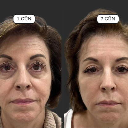 Elverna® Lenf Masaj Fırçası