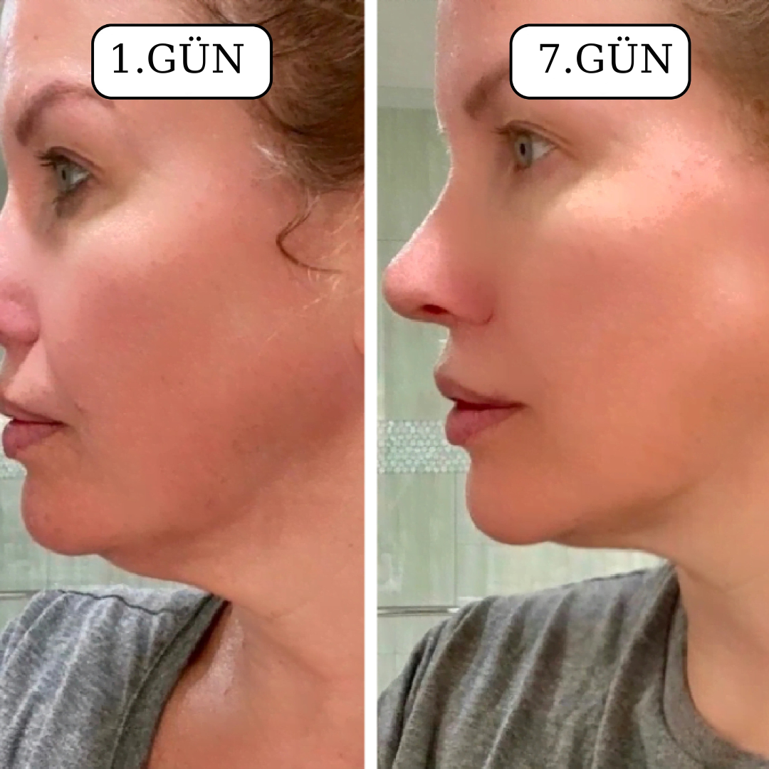 Elverna® Lenf Masaj Fırçası